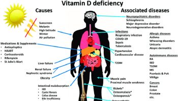 Vitamin-D-deficiency