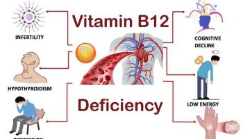 vitamin b12 deficiency