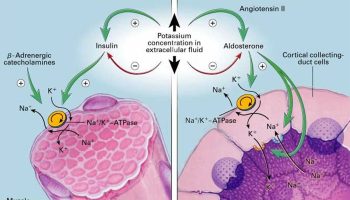 hypokalemic periodic paralysis