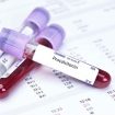 Procalcitonin