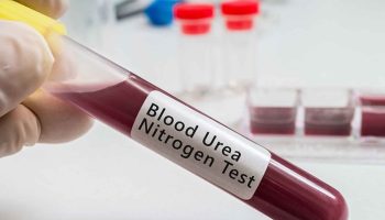 blood-urea-nitrogen