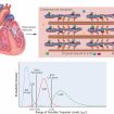 troponin