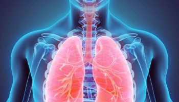 Restrictive-lung-disease