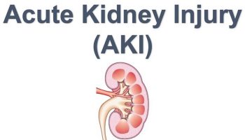 acute kidney injury