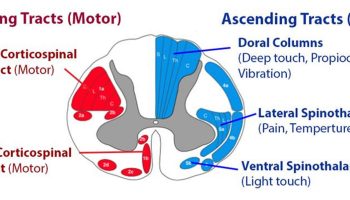 central-cord-syndrome