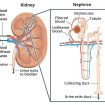 glomerular disease