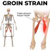 groin-strain