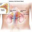 Adrenal cortical carcinoma