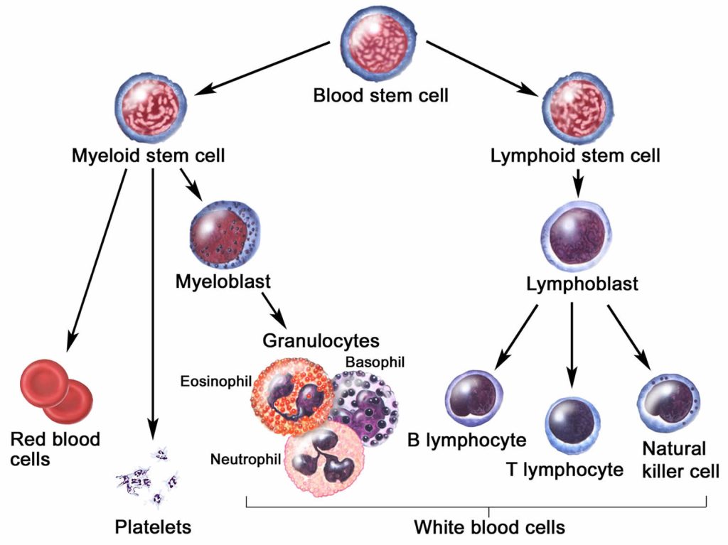 Secondary hemophagocytic lymphohistiocytosis, causes, symptoms ...