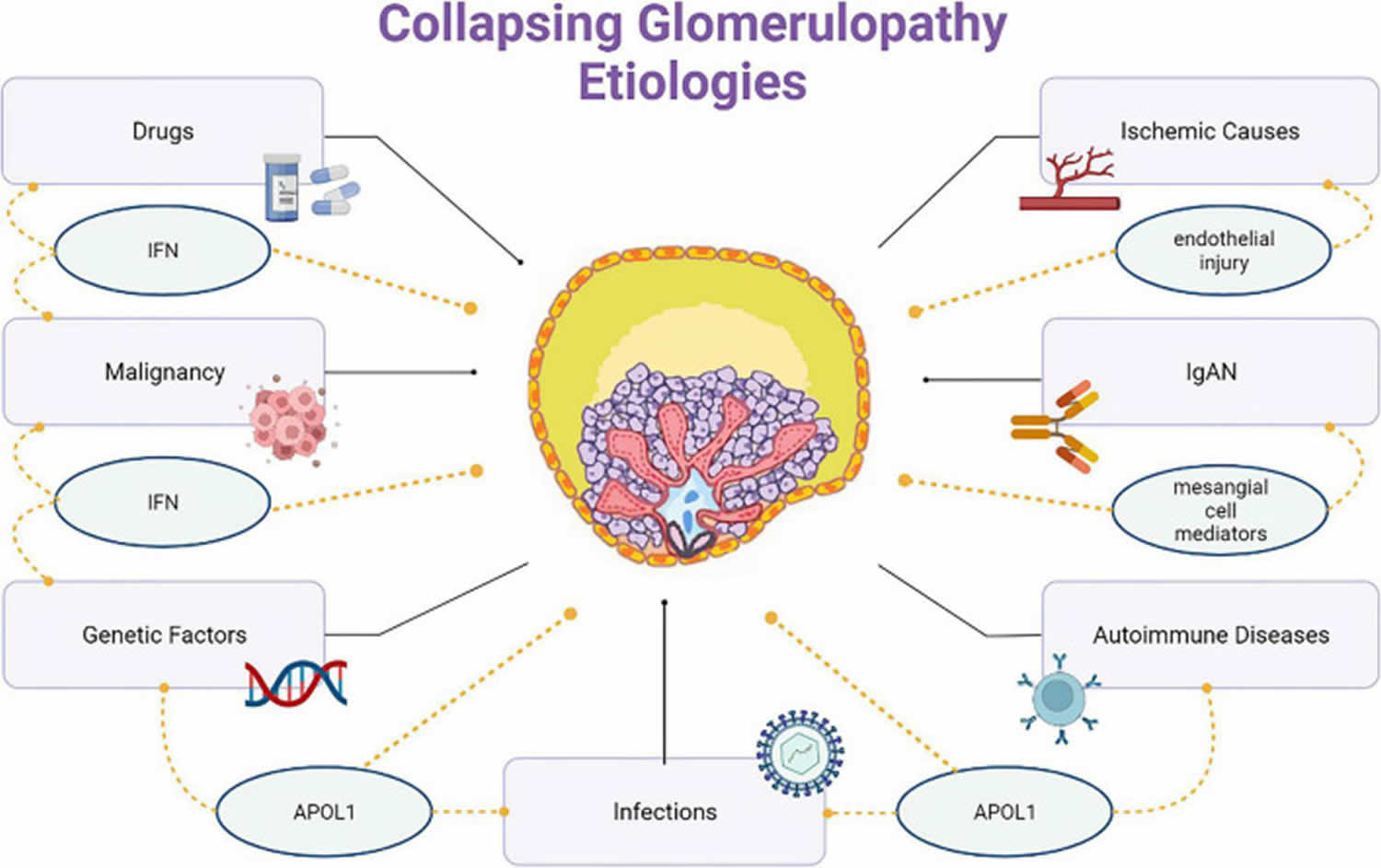 Collapsing glomerulopathy causes