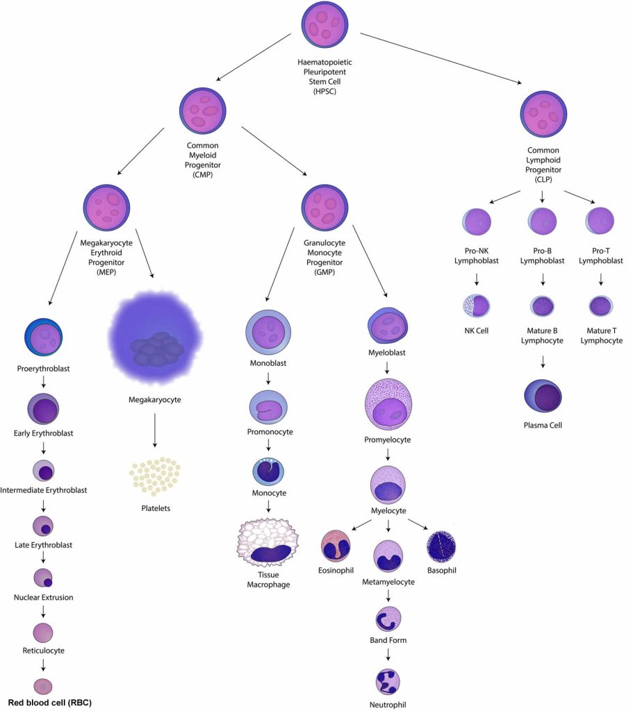 Myelodysplasia, MDS, causes, symptoms, diagnosis, treatment & prognosis