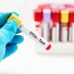 STD testing