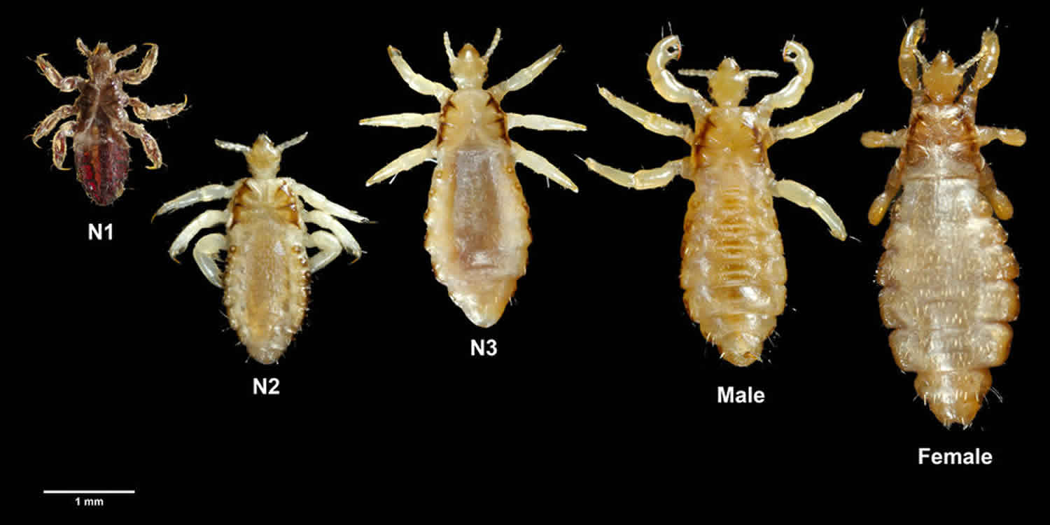 Human body louse