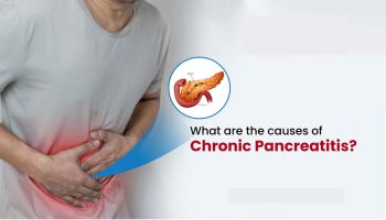 Chronic pancreatitis