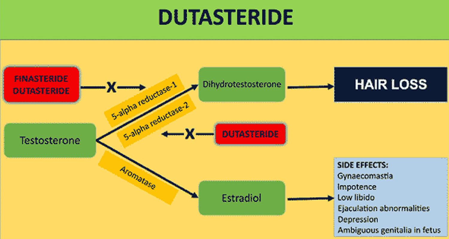 Dutasteride mechanism of action