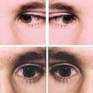 Oscillopsia