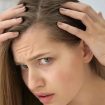 female pattern baldness