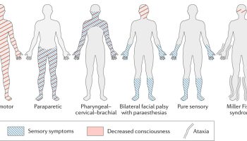 guillain barre syndrome