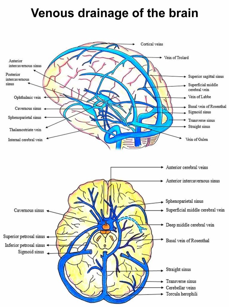 Cerebral venous thrombosis causes, risk factors, symptoms, diagnosis ...