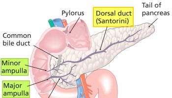 Pancreas divisum