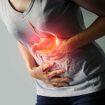 Gastritis