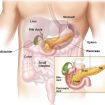 zollinger ellison syndrome
