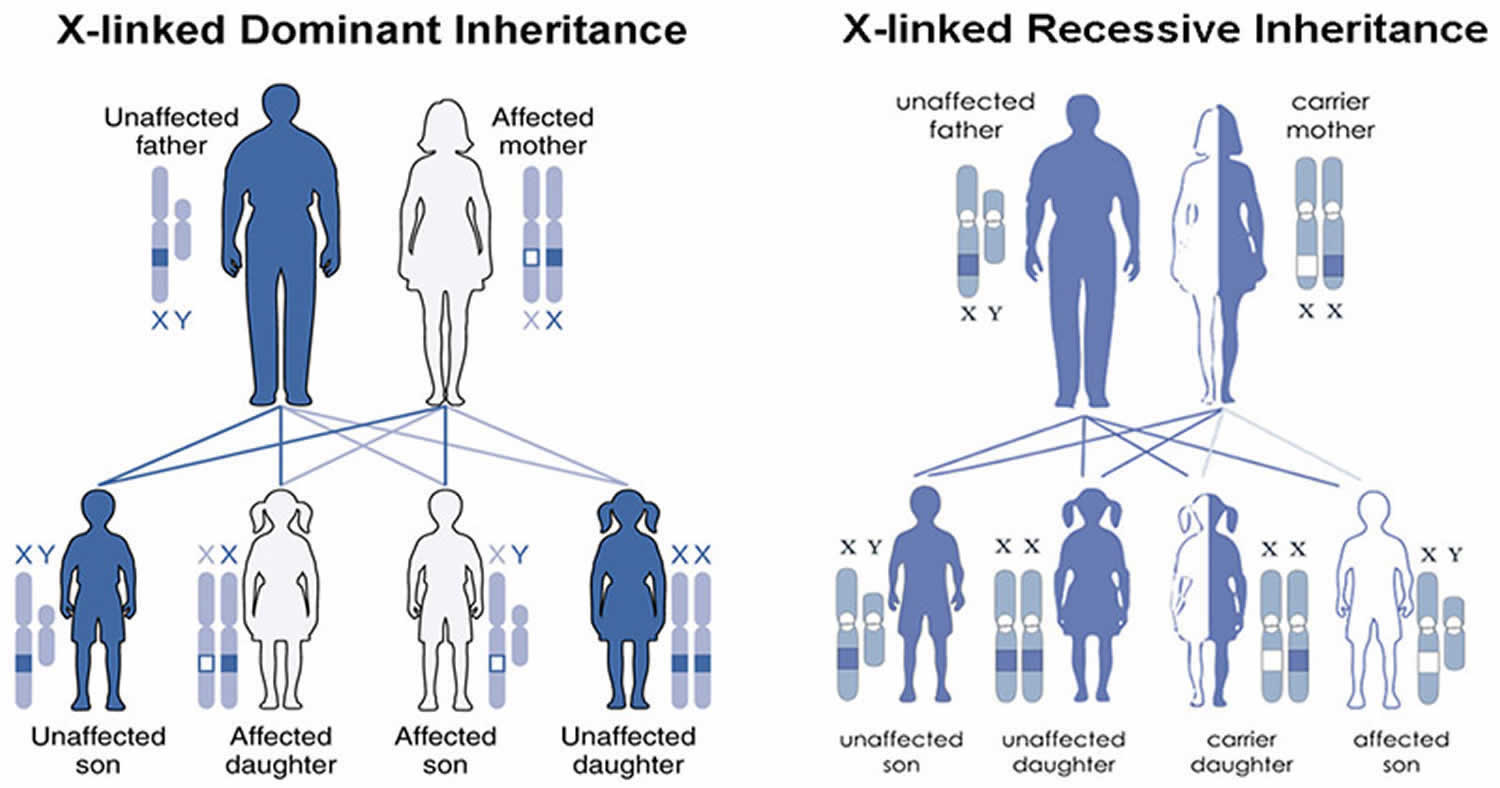 Cornelia de Lange syndrome X-linked inheritance pattern
