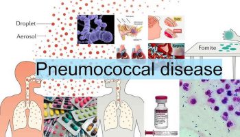 pneumococcal disease