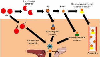 intravascular-hemolysis