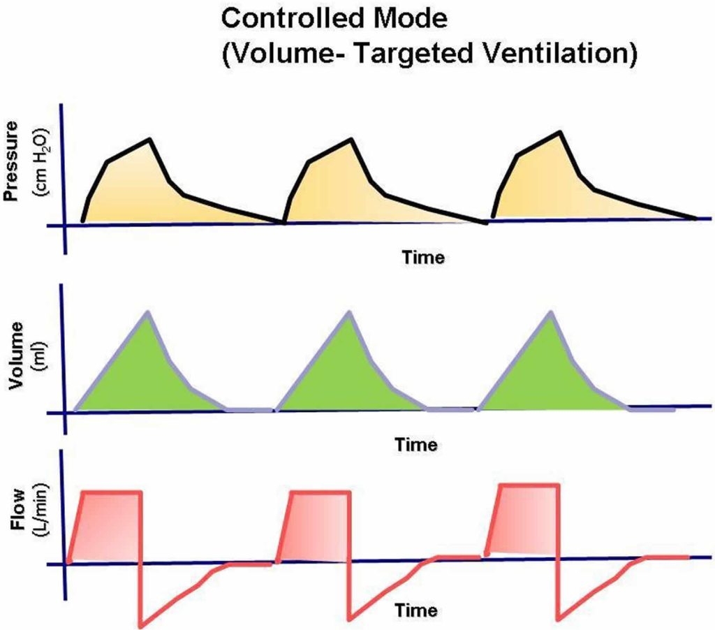 Mechanical ventilation types, indications, complications, settings & modes