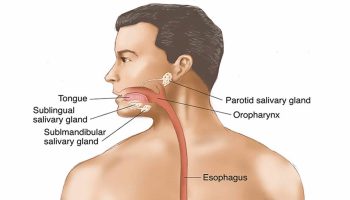 Typhlitis