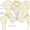 Pelvic fracture