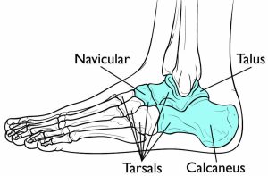 Tarsal coalition causes, symptoms, diagnosis & treatment