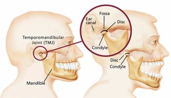 temporomandibular joint disorders