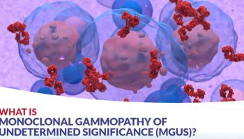 Monoclonal gammopathy of undetermined significance