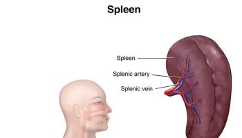 Splenic-abscess