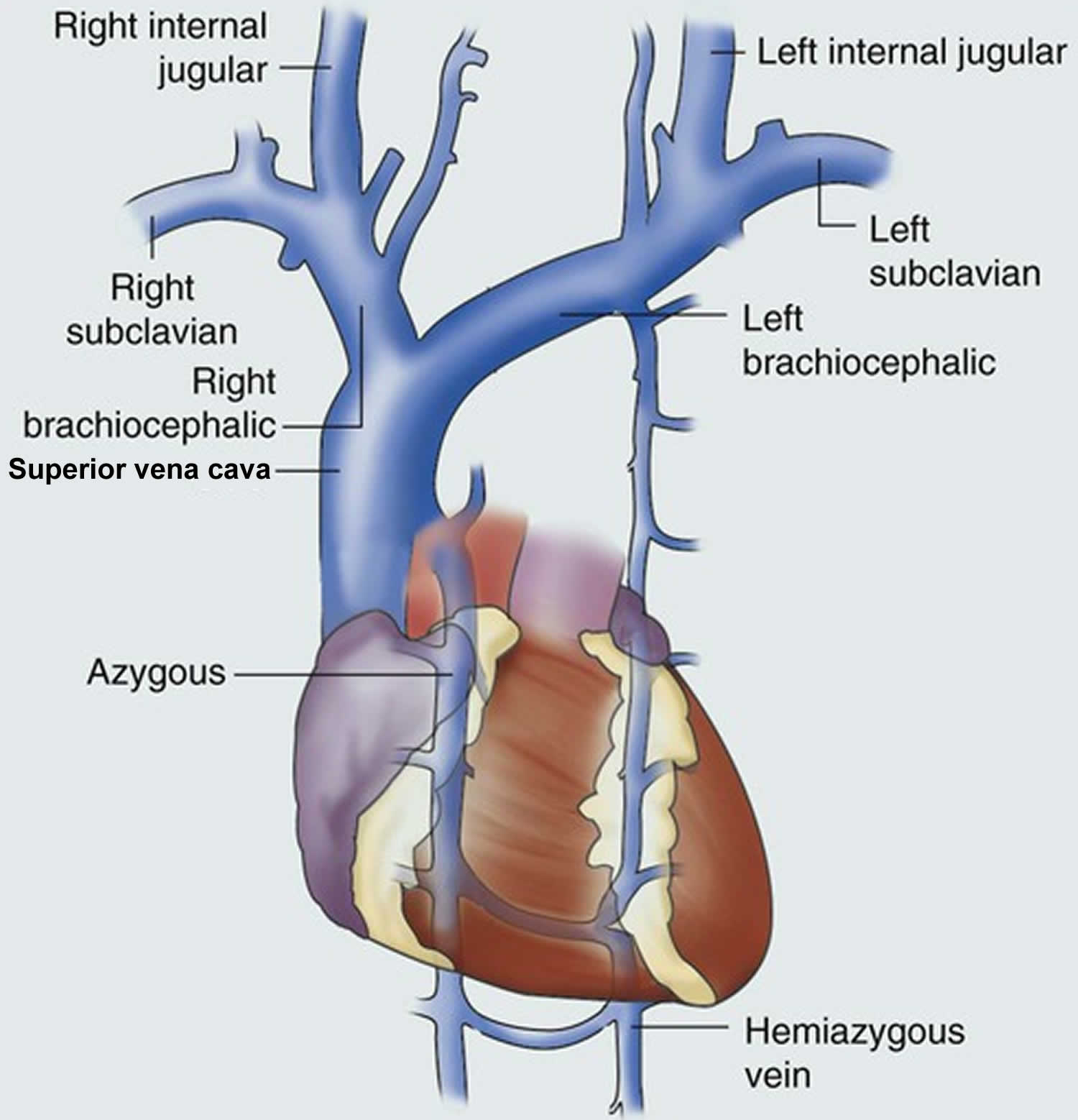 Superior vena cava syndrome, causes, symptoms, diagnosis, treatment ...