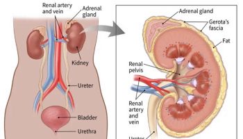 end-stage renal disease