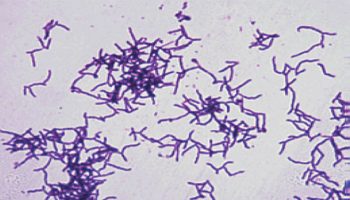 Actinomyces-israelii
