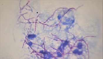Nocardia