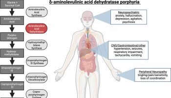 ALA dehydratase deficiency porphyria