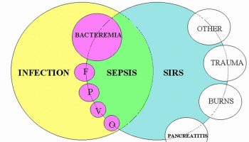 systemic-inflammatory-response-syndrome