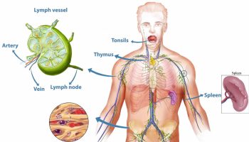 Splenomegaly