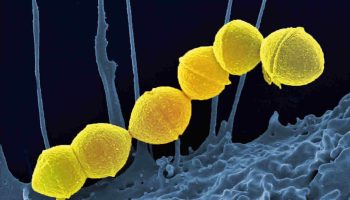 Streptococcus Pyogenes