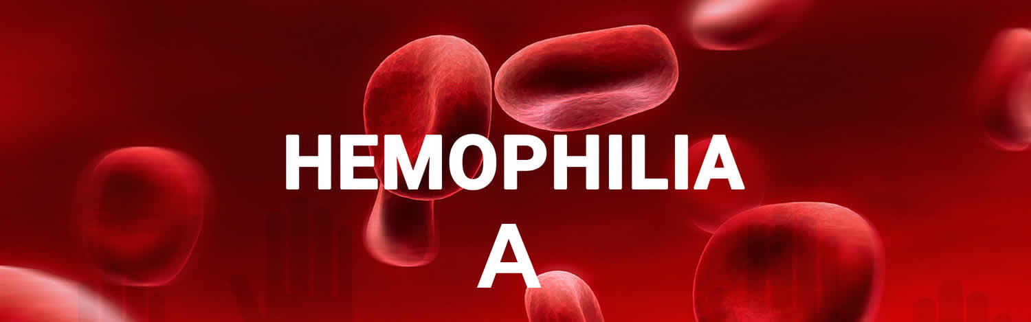 hemophilia A