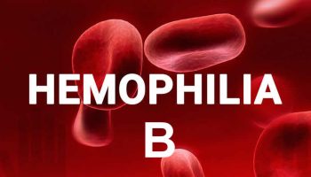 hemophilia B